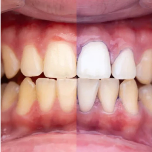 Albitor Dentar V34 GLUMI