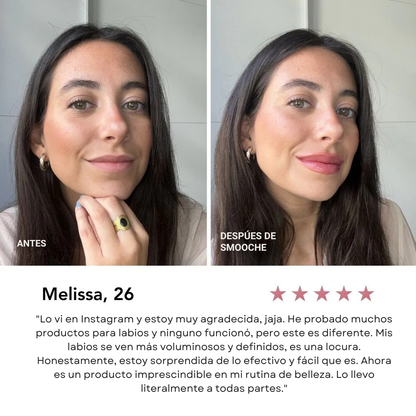 Voluminizador de Labios Glumi