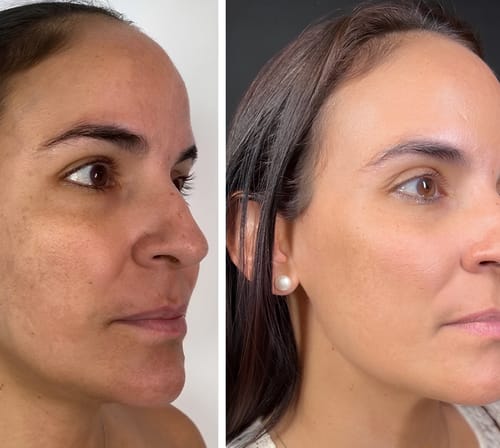 Tenho 46 anos e já tentei de tudo. Este bálsamo foi o único que realmente sinto que reafirma a pele. Até minhas amigas me perguntaram o que estou usando.